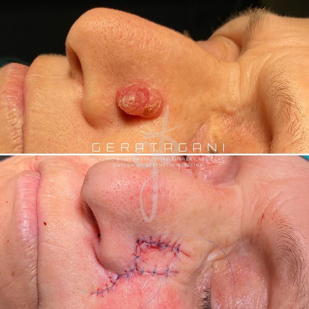 Before and After Result